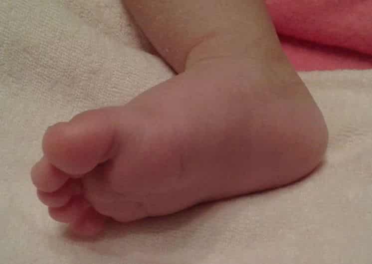 “Hogares de Belén” da abrigo a bebé golpeado por su mamá