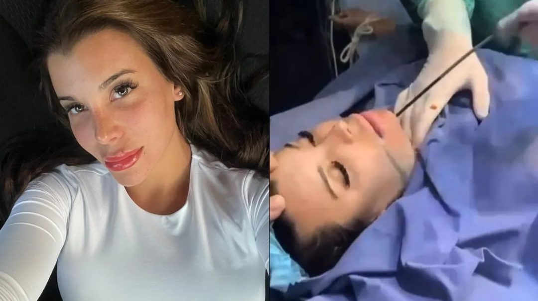 Charlotte Caniggia se grabó en el quirófano y mostró la impactante cirugía estética a la que se sometió