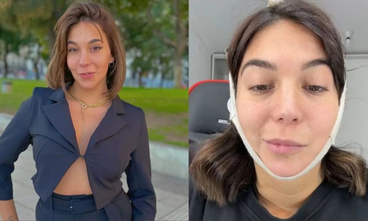 Luciana Milessi se hizo cuatro operaciones y ahora tiene parálisis facial:  “Me dijeron que la saqué barata”