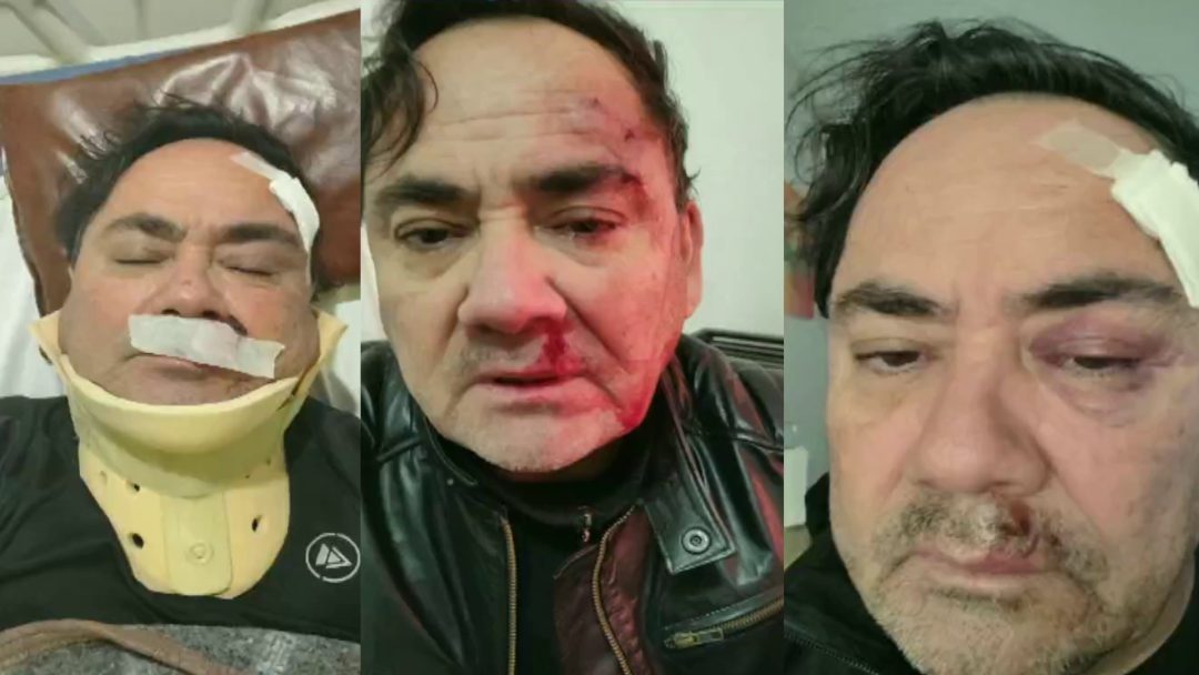 Habló el director golpeado brutalmente en un hogar de menores: “Nunca había experimentado una situación de violencia como esta”