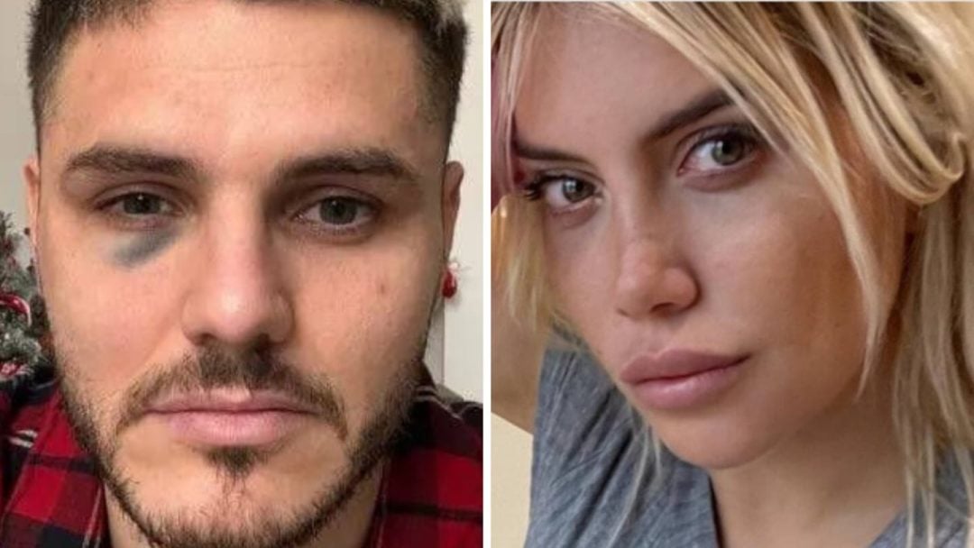 Todo se fue de las manos: Wanda Nara denunció por violencia de género a Mauro Icardi